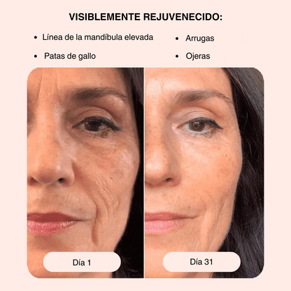 Masajeador Facial 4x1: Rejuvenece Tu Piel