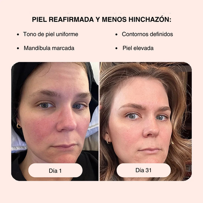 Masajeador Facial 4x1: Rejuvenece Tu Piel